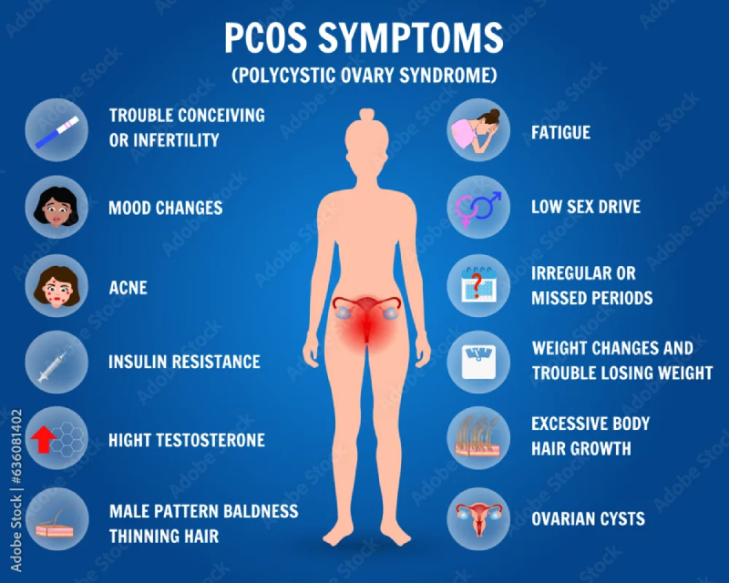 Diagram showing symptoms of PCOS affecting hormones, metabolism, menstrual cycles, skin, hair, and overall health